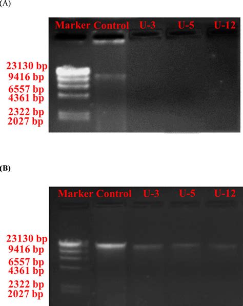 Agarose Gel Electrophoresis Of Genomic DNA Of Escherichia Coli A And