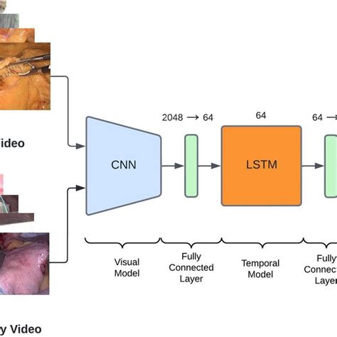 Overview Of The Surgical Workflow And Definition Of Phases In The Download Scientific Diagram