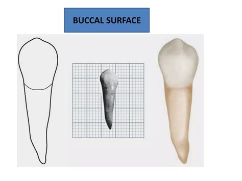 Permanent Mandibular First Premolar Ppt