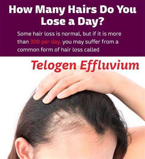 Telogen Effluvium Hpi Hair Partners Nashville Diffuse Thinning