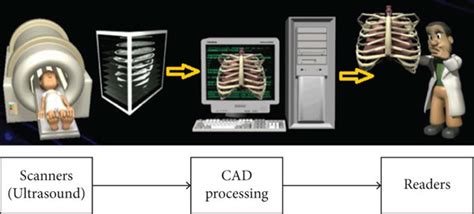 General Flow For Computer Aided Diagnosis Download Scientific Diagram