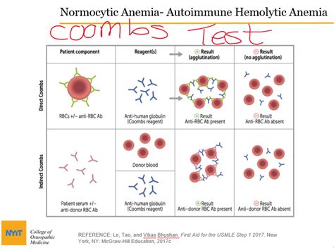 Indirect Coombs Test Astonishingceiyrs