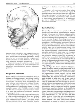 Total maxillectomy | PDF