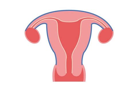 Endometrial Hyperplasia symptoms, causes, treatment, medicine, prevention, diagnosis