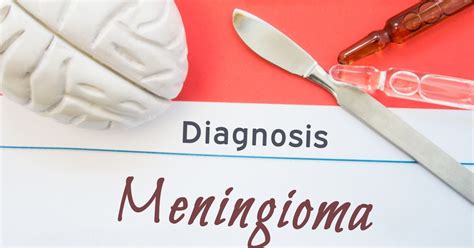 10 Symptoms of Meningioma - Facty Health