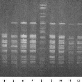 Pfge Profiles Of Genomic Dnas From Clinical Isolates Of N