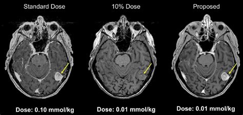 Magnetism Questions And Answers In MRI