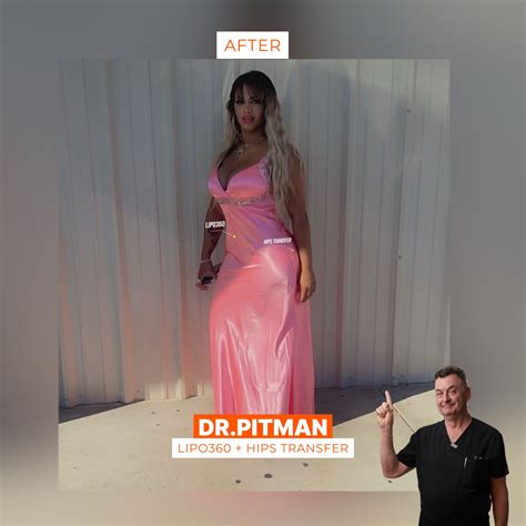 Smart Plastic Surgery | Miami FL