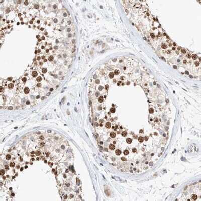 CRAT Antibodies: Novus Biologicals