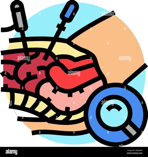 Laparoscopy Surgery Hospital Color Icon Vector Illustration Stock