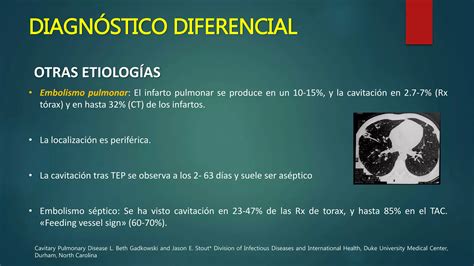 Lesiones Pulmonares Cavitadas Ppt