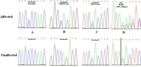 Dna Sequences Of Grygd In Affected And Control Individuals Four