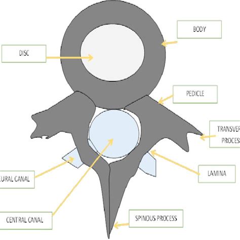 Spinal Canal Measurement In An Axial Ct Scan Of A Lumbar Vertebra At