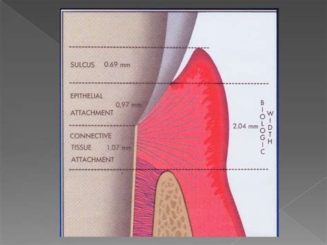 Biologic width - Importance in Periodontal and Restorative Dentistry