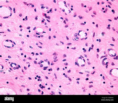 Light Micrograph Of Small Blood Vessels Mostly Arterioles Located In