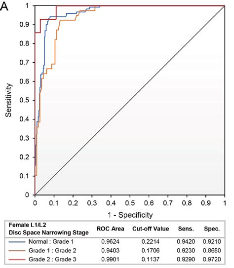 A An Example Of Roc Curve And Diagnostic Ability For L L Dsn In