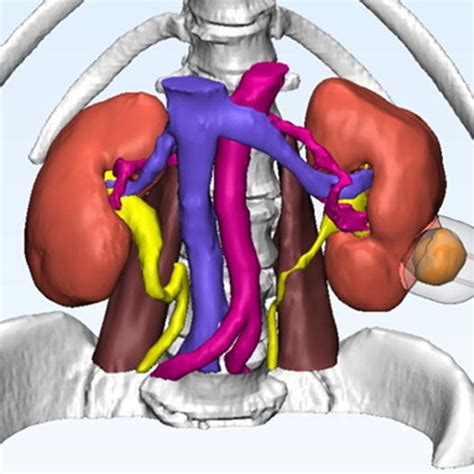 Renal Cryoablation Model Shown In A 2d Segmented Form B 3d Electronic Download Scientific