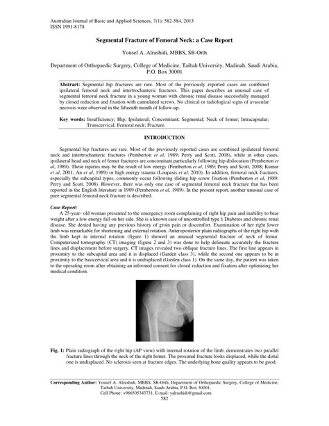 (PDF) Segmental Fracture of Femoral Neck: a Case Report