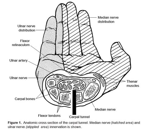 AAOS Guidelines On Carpal Tunnel Diagnosis RheumNow