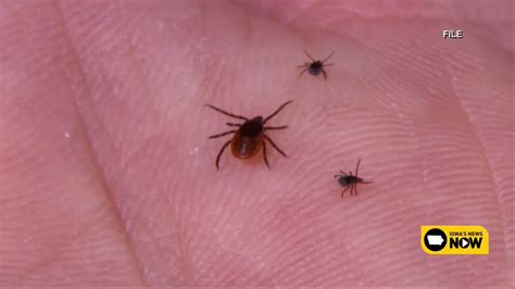 Iowa In The Thick Of Tick Season How To Stay Safe From Disease