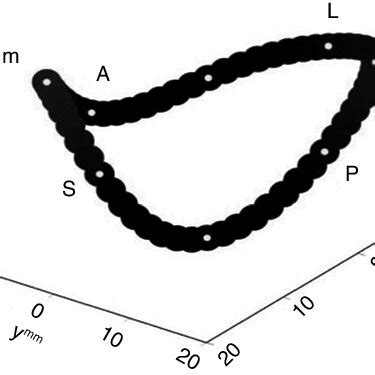 Three-Dimensional Shape of the Tricuspid Annulus. Based on a ...