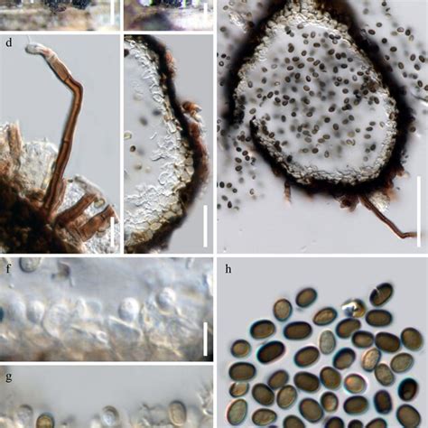 Coniothyrioidesthailandica Sp Nov Mflu Holotype A B