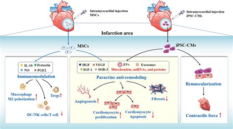 Stem Cell Based Therapy In Cardiac Repair After Myocardial Infarction