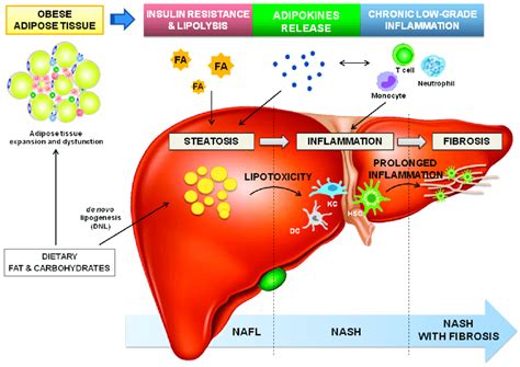 Dysfunctional Adipose Tissue Driven Pathophysiology Of NAFLD The