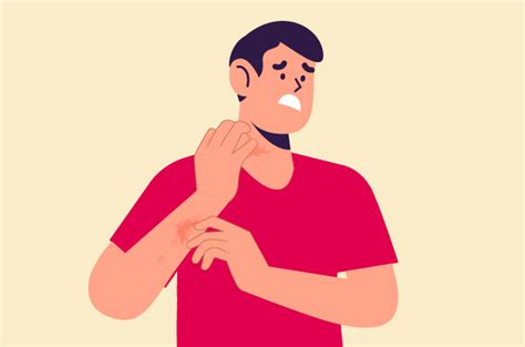 Tinea Barbae Gejala Penyebab Dan Pengobatan Halodoc