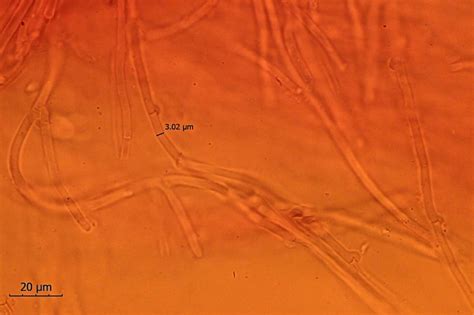 Ist Das Byssomerulius Incarnatus Pilzbestimmung U Bestimmungshilfe