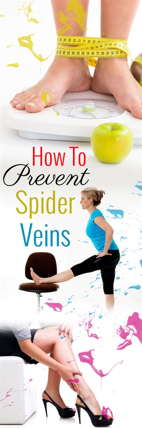 How to Prevent Spider Veins