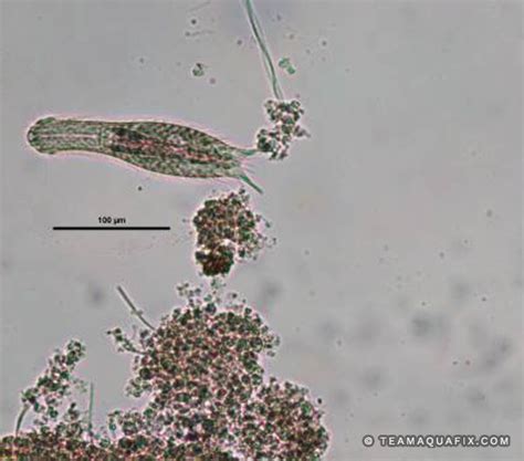 Gastrotrich - Aquafix