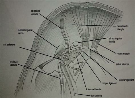 Inguinal Nerve Anatomy