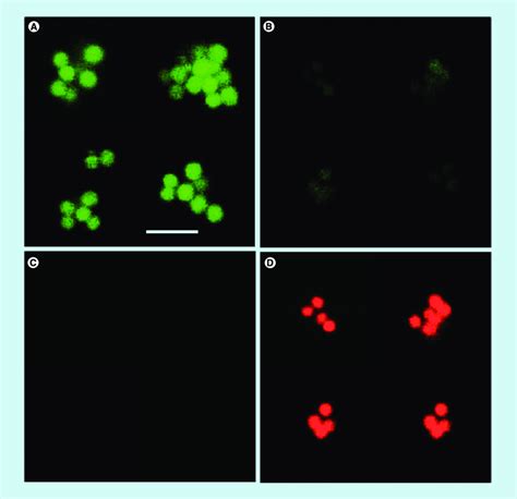 Bactericidal Effect Of The Peptide P5 Is Related To Permeabilization Of Download Scientific