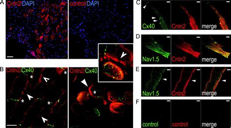 Contactin 2 Expression In The Cardiac Purkinje Fiber Network