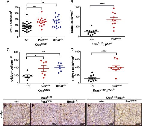 Circadian Rhythm Disruption Promotes Lung Tumorigenesis Cell Metabolism