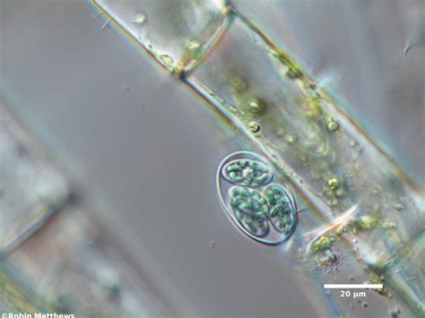 (Glaucophyta) Тип Глаукофиты, Глаукофитовые водоросли, Глаукоцистофиты ...