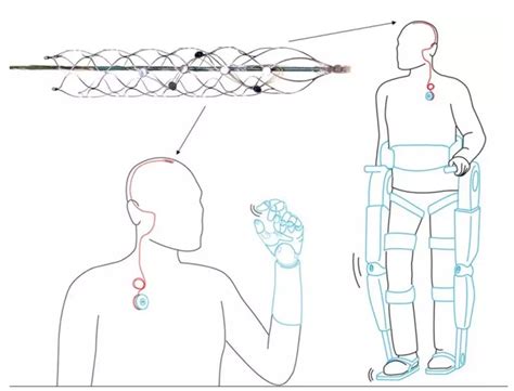 How ‘mind Controlled Bionic Devices Could Help Quadriplegics Walk