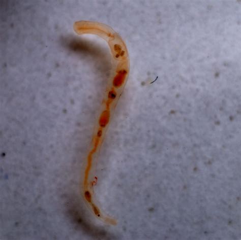 Chaetogaster This Is A Commensal Living Needle Worm Livin Flickr