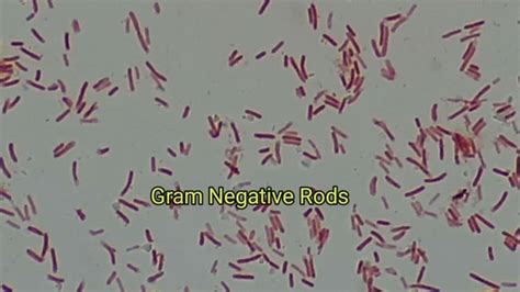 Gram Negative Rods Of Klebsiella Pneumoniae