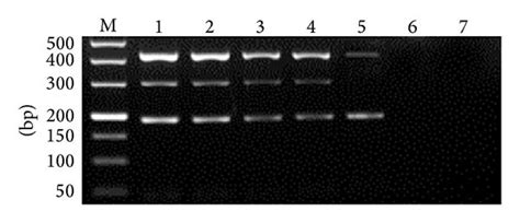 Sensitivity Of Multiplex PCR M DL2000 DNA Marker 17 Tenfold Serial