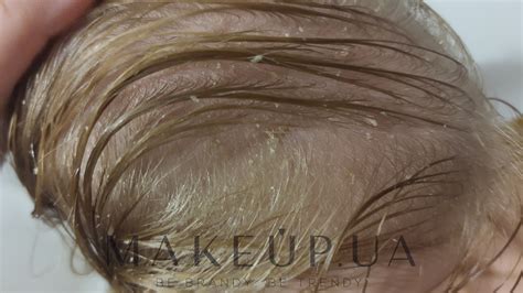 Дитячий шампунь проти себорейних кірочок - Babe Laboratorios Cradle Cap ...