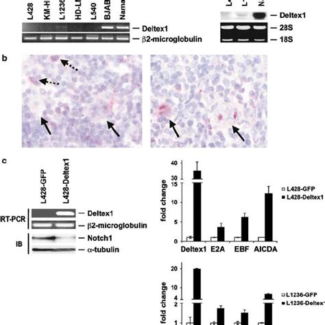 Absence Of The Notch Inhibitor Deltex In Hrs Cells A Mrna