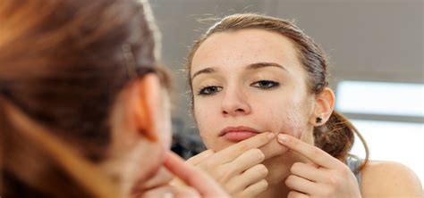 Understanding Hormonal Acne Causes Treatments And Dietary Tips