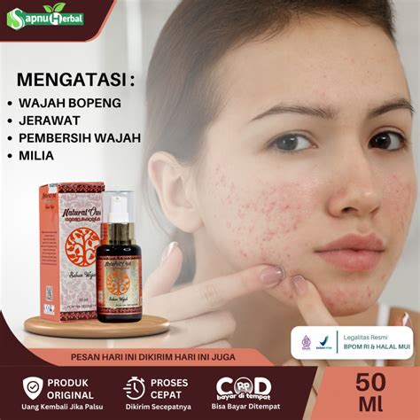 Jual Sapnu Herbal Sabun Penghilang Bopeng Obat Penghilang Bopeng Di