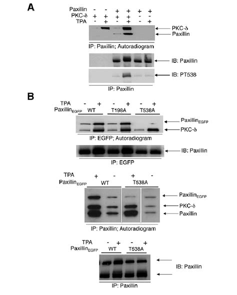 Pkc Phosphorylates Paxillin In Vitro We Used Parental Baf A Or