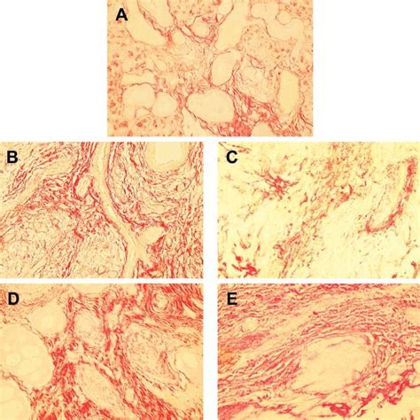 Representative Picrosirius Red Staining Of Different Salivary Gland Download Scientific Diagram