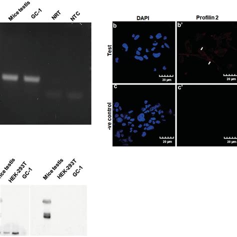 Profilin In Testis And Gc Cells At Transcript And Protein Level