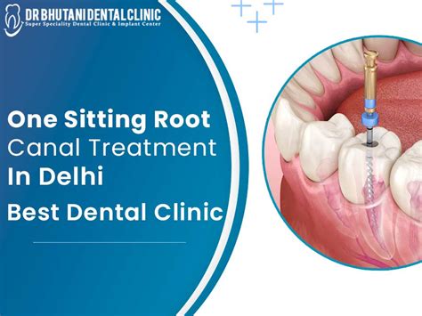 Single Sitting Rct Best Dental Clinic In Delhi Dr Bhutani