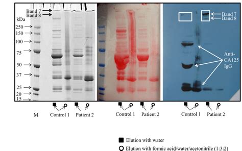 Sds Page And Western Blot Identification Of Ca Elution Of Ca